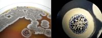 Imágenes de Streptomyces, el género más extenso de actinobacterias.