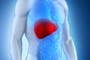 Una de las patologías del hígado es la esteatohepatitis no alcohólica (NASH, por sus siglas en inglés), se caracteriza por la presencia de grasa, inflamación y daño en las células hepáticas en sujetos que no consumen alcohol, pero que tienen malos hábitos alimenticios, presentan sobrepeso u obesidad, colesterol y triglicéridos altos y diabetes o prediabetes.