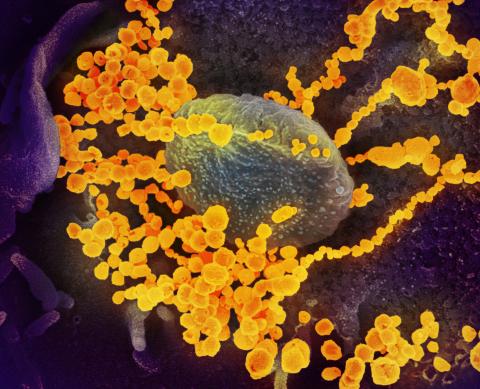 Esta imagen de microscopio electrónico de barrido muestra al SARS-CoV-2 (objetos de oro redondos) emergiendo de la superficie de células cultivadas en el laboratorio. El SARS-CoV-2 es el virus que causa la COVID-19. El virus que se muestra fue aislado de un paciente en los EE.UU. 