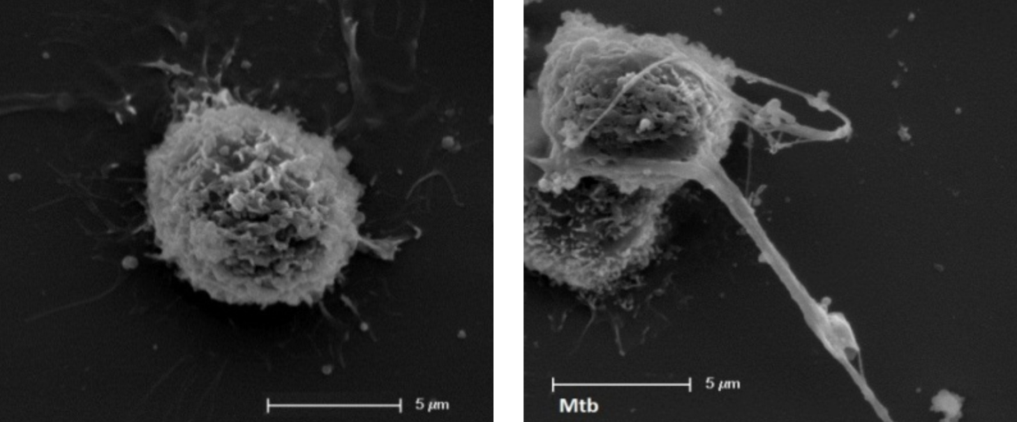 Una de las funciones que se han observado en los mastocitos es la de contribuir a contener una infección. A la izquierda se observa a la célula en reposo y a la izquierda cuando está produciendo trampas extracelulares que capturan a la infección a inducen su muerte. 