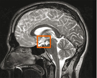 El núcleo supraquiasmático es el eje rector del sistema circadiano, el cual influye en la presión arterial. En el estudio de esta estructura del cerebro se centró un grupo de investigadores de la UNAM, Cinvestav y la Escuela Médica de Harvard para conocer si dicho núcleo está incorporado a un circuito cerebral que regule la presión sanguínea.