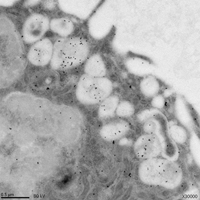 Microfotografía electrónica de células de insecto infectadas con virus dengue, mostrando extensa vacuolización y la presencia de la proteína NS1 (revelada por inmunomarcaje con partículas de oro coloidal) dentro de las vacuolas.