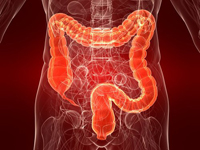 La colitis ulcerosa y la enfermedad de Crohn, padecimientos que atacan principalmente a poblaciones de países desarrollados, pero que están aumentando en naciones en vías de desarrollo como el nuestro, se caracterizan por la destrucción del epitelio intestinal provocado por la formación de múltiples úlceras en el intestino.