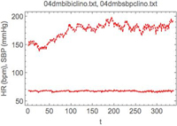 Monitoreo continuo y no-invasivo de la frecuencia cardiaca en unidades de latidos por minuto (curva continua inferior en cada panel) y presión arterial sistólica (curva quebrada superior en cada panel) durante 5 minutos en reposo supino en un paciente con varios años de diabetes mellitus tipo 2.